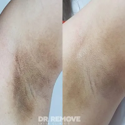 2025041620480882 2025041620480882