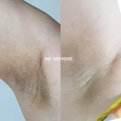 2025041620490199 2025041620490199