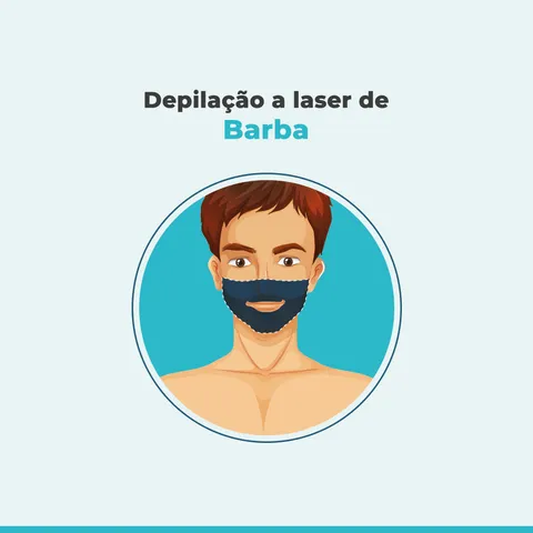 07 Depilação a laser de Barba
